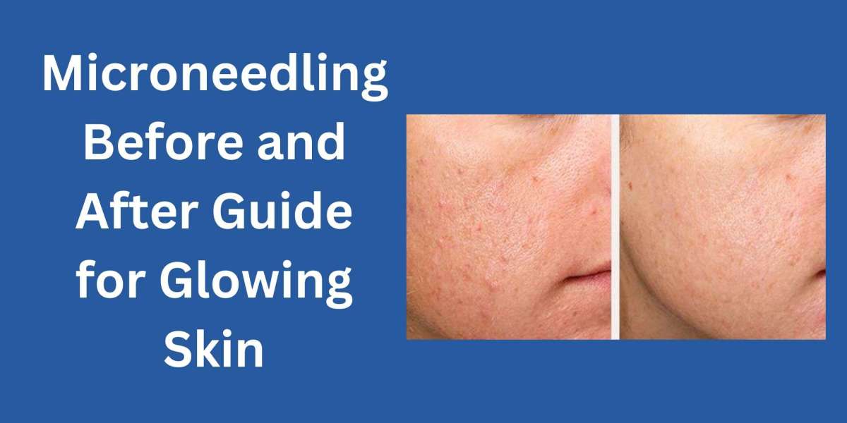 Microneedling Before and After Guide for Glowing Skin