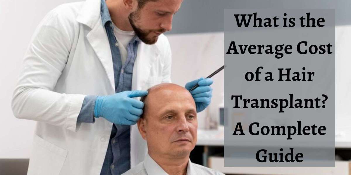 What is the Average Cost of Hair Transplant? A Complete Guide