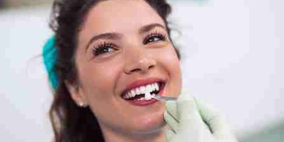 Smooth Implant Experience: The Pre-Procedure Checklist You Need