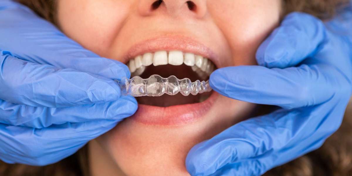 How Invisalign Works with Complex Orthodontic Cases