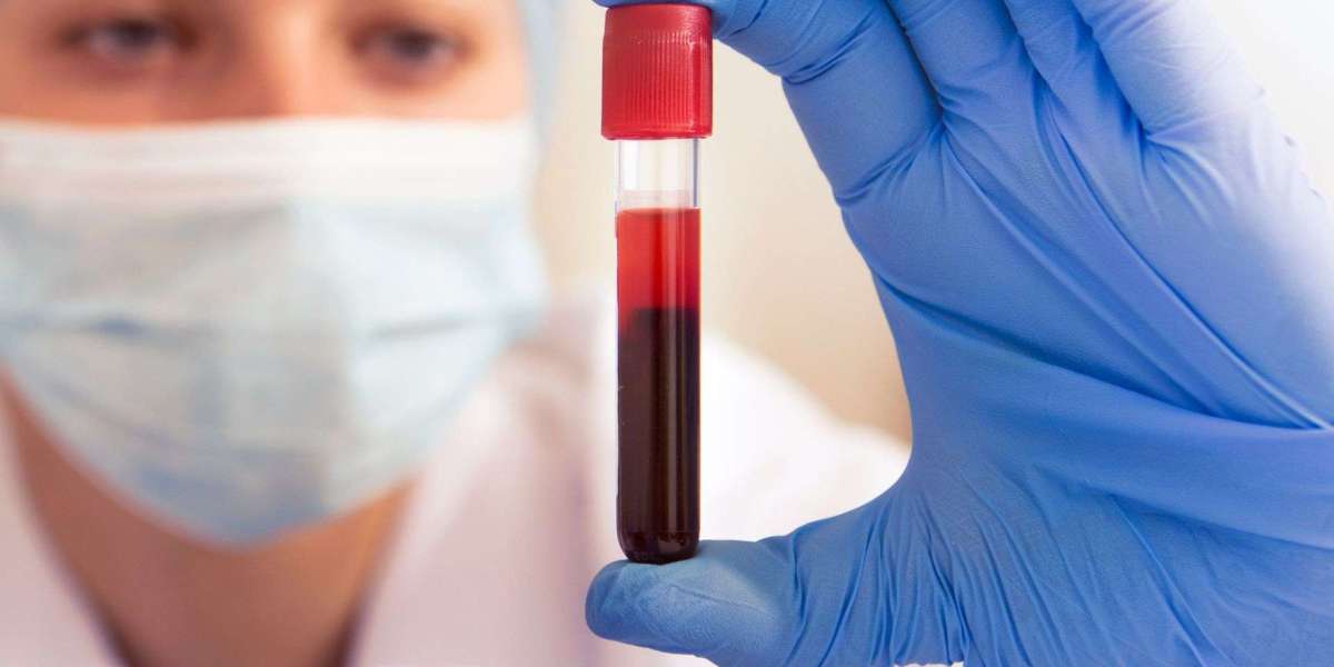 Top 10 Key Reasons to Have a Blood Test in London