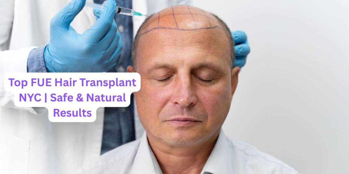 Top FUE Hair Transplant NYC | Safe & Natural Results