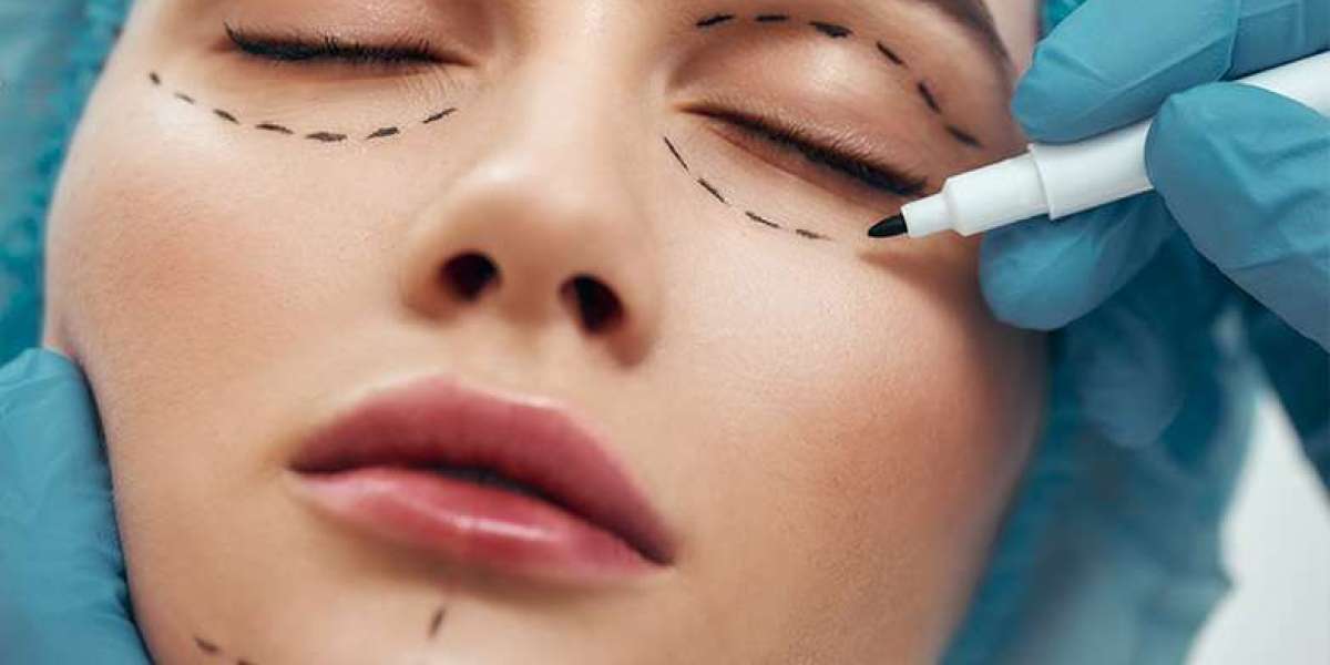 Revive Your Eyes with Advanced Eyelid Surgery In Islamabad