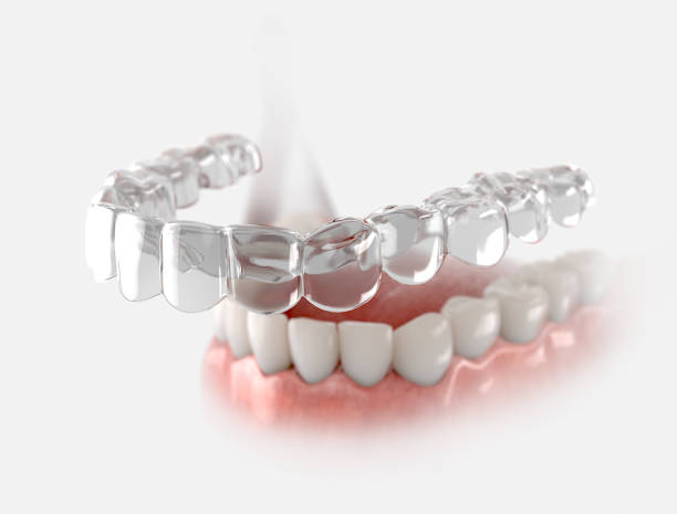 Invisalign in Ridgefield CT: A Modern Approach to Discreet Teeth Straightening : ridgefieldortho — LiveJournal